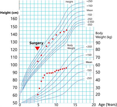 Case report: Pediatric hepatopulmonary syndrome despite strict weight control after craniopharyngioma surgery